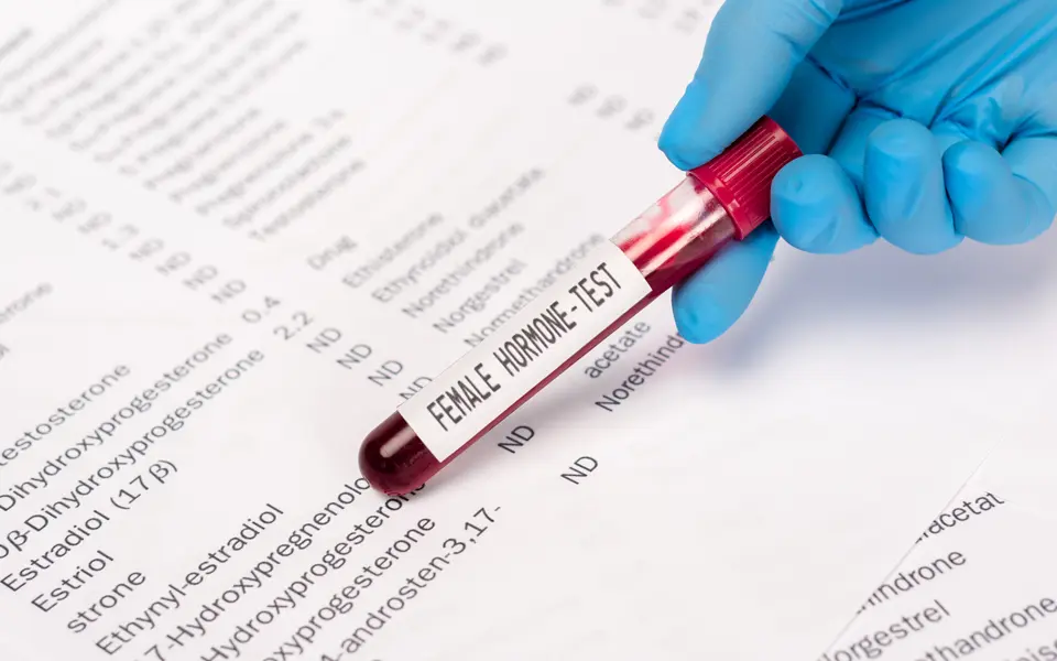 cropped-view-of-doctor-holding-test-tube-with-samp