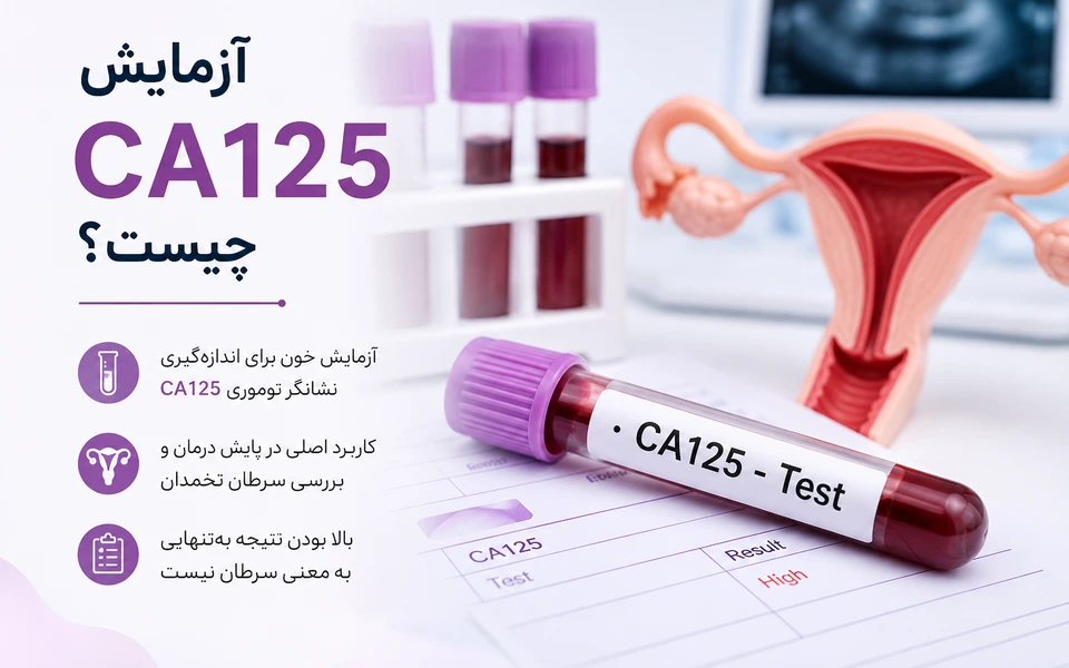 آزمایش CA125 چیست؟ تفسیر نتیجه، علت بالا بودن و کاربردها