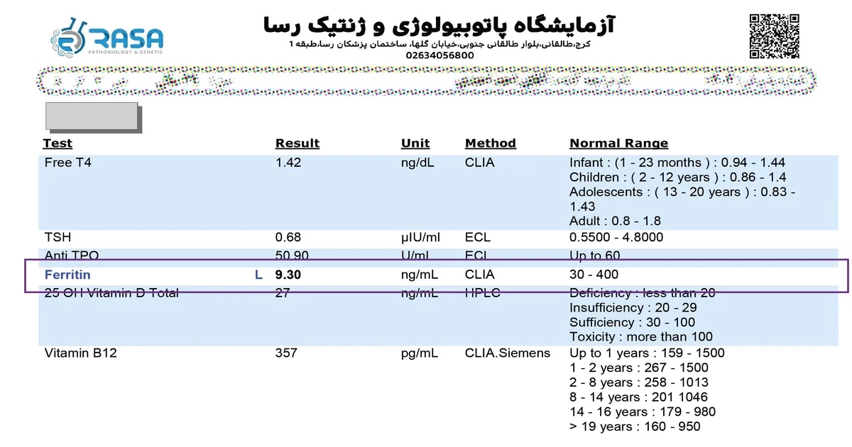 نتیجه آزمایش ferritin پایین