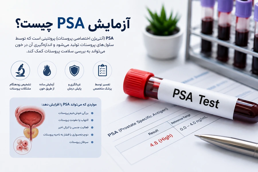 آزمایش PSA چیست؟ کاربرد، آمادگی و تفسیر نتیجه